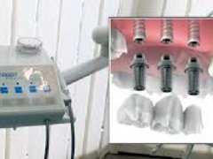 Dentexcela - clinica stomatologica
